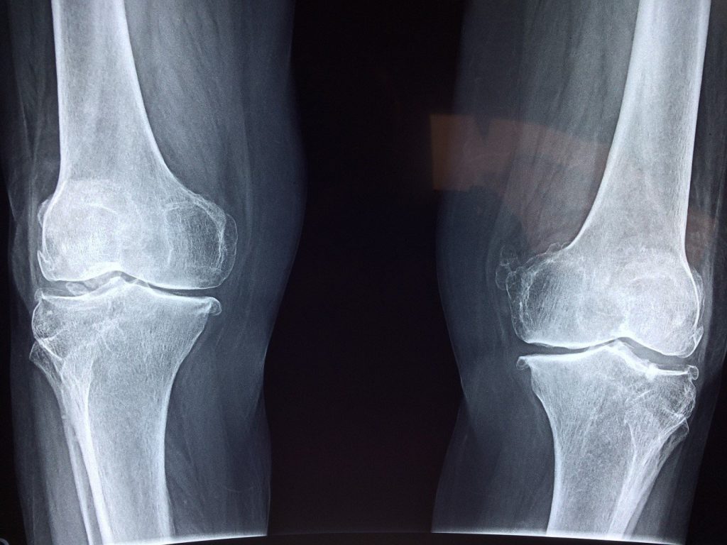 knee x-ray